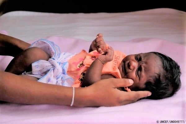 保健センターに連れられてきた、生まれたばかりの子ども。(スリランカ、2022年6月3日撮影) © UNICEF_UN0649777_