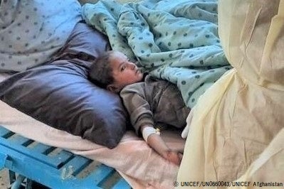 パクティア州・ウルグン(Urgun)地区の病院で、治療を受ける被災した女の子。(アフガニスタン、2022年6月22日撮影) © UNICEF_UN0660043_UNICEF Afghanistan