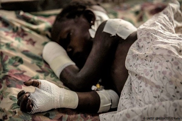 東部のイトゥリ州ブニアの病院のベッドで横になる女の子。ナタで手を切り落とされ、治療を受けた。保護者がおらず身元も分からない。(コンゴ民主共和国、2022年2月撮影) © UNICEF_UN0594337_OReilly