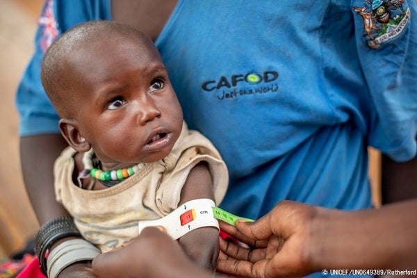 北東部モロトの外来治療センターで、上腕計測メジャーを使った栄養検査を受ける1歳のアコルちゃん。「赤」が示され、重度の栄養不良と診断された。(ウガンダ、2022年5月撮影) © UNICEF_UN0649389_Rutherford