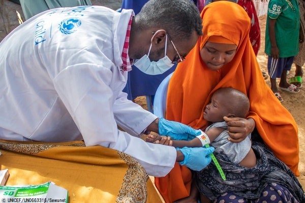 国内避難民キャンプに避難している子どもの栄養状態をチェックするユニセフスタッフ。 （ソマリア、2022年6月撮影）© UNICEF_UN0663316_Sewunet