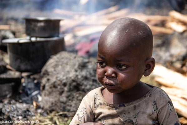 東部北キブ州の戦闘激化により、ゴマの国内避難民キャンプに逃れてきた4歳のジャスティンちゃん。(コンゴ民主共和国、2022年5月撮影) © UNICEF_UN0647203_Wenga