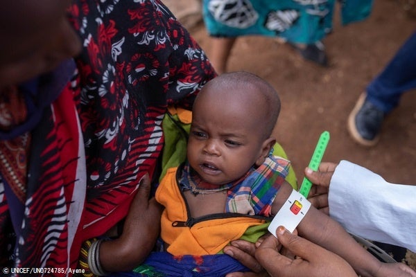 ユニセフの栄養検査と治療キャンペーンで、重度の栄養不良と診断された生後7カ月のウブサちゃん。干ばつの影響により逃れた国内避難民キャンプで治療を受け、状態は回復しつつある。(コンゴ民主共和国、2022年10月撮影) © UNICEF_UN0724785_Ay