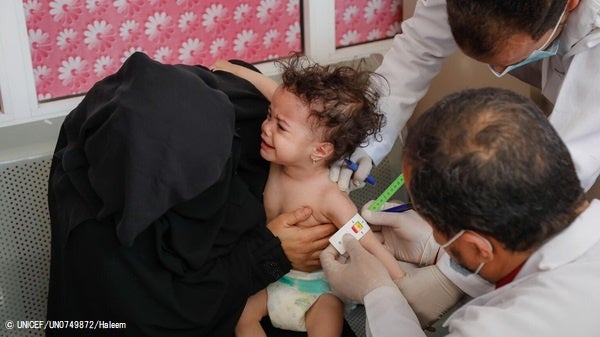 病院で、上腕計測メジャーを使った栄養検査を受ける生後8カ月のジャナちゃん。(イエメン、2022年12月撮影) © UNICEF_UN0749872_Haleem