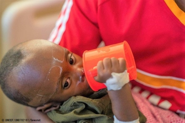 干ばつの影響により故郷からモガディシュに逃れた1歳のモハメドちゃん。食べ物を食べていなかったため安定化センターに入院し、回復しつつある。(ソマリア、2023年2月6日撮影) © UNICEF_UN0782161_Sewunet
