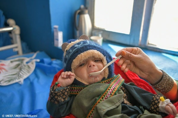 ダーイクンディー州立病院で、治療用ミルクを口にする重度の急性栄養不良と診断された生後6カ月のアジマルちゃん。(アフニガスタン、2023年5月2日撮影) © UNICEF_UN0838550_Karimi