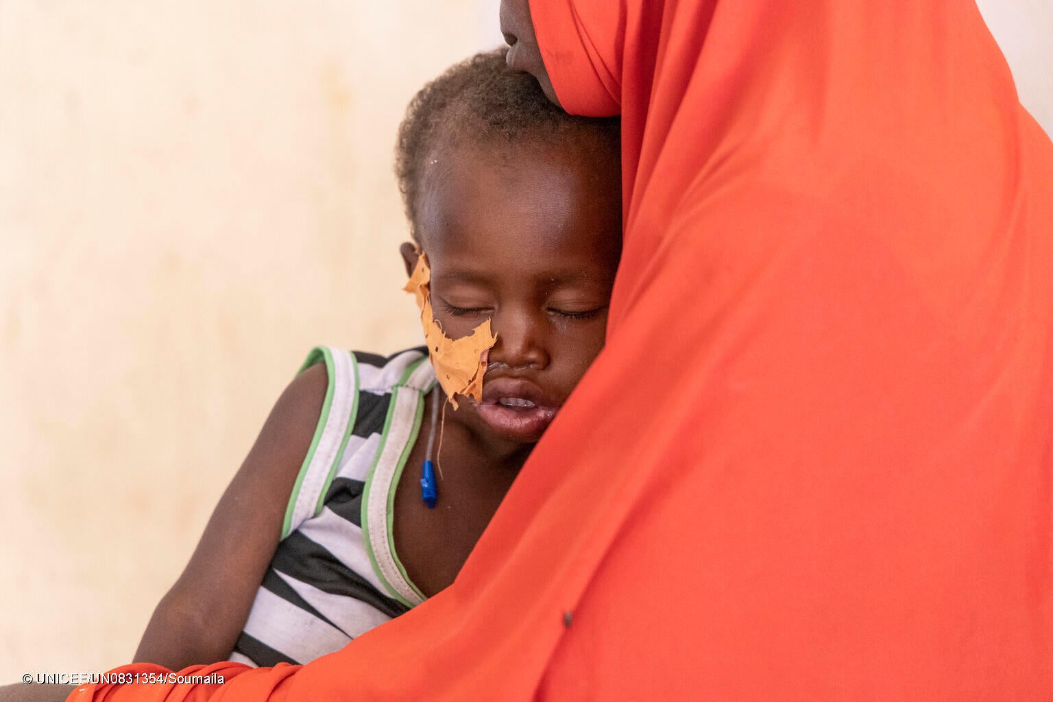 病院の集中栄養回復センターで治療を受ける、重度の急性栄養不良の1歳のラウアリちゃん。(ニジェール、2023年3月撮影) © UNICEF_UN0831354_Soumaila