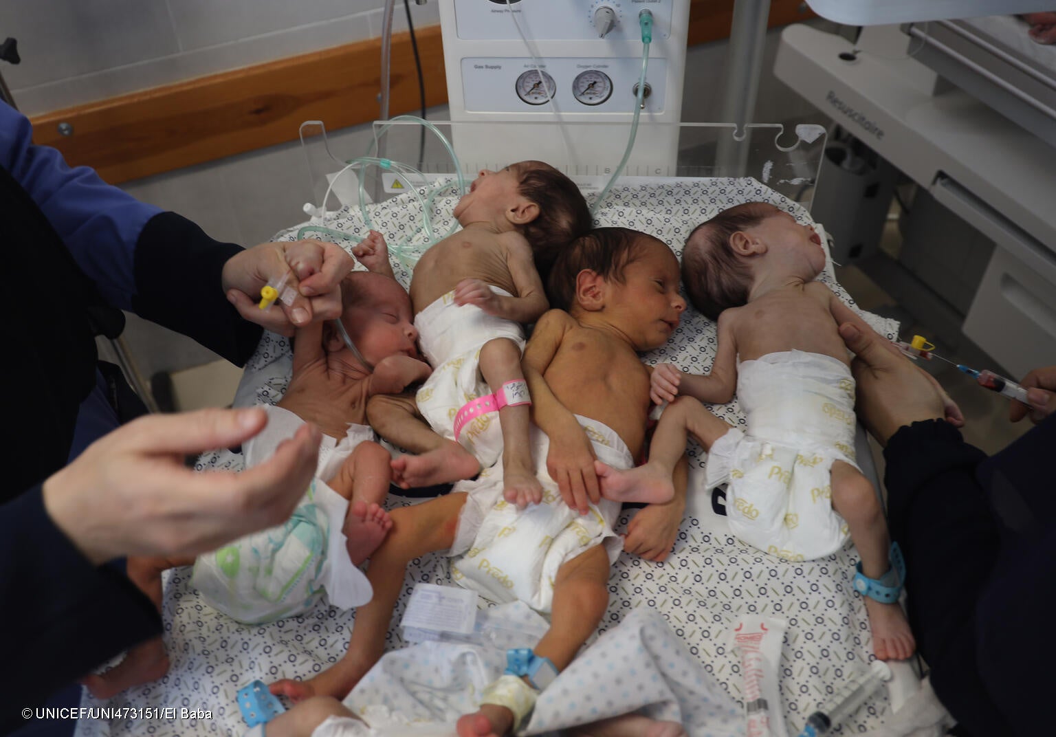 北部のアルシファ病院からラファにある病院へ移送された新生児。(ガザ地区、2023年11月19日撮影) © UNICEF_UNI473151_El Baba