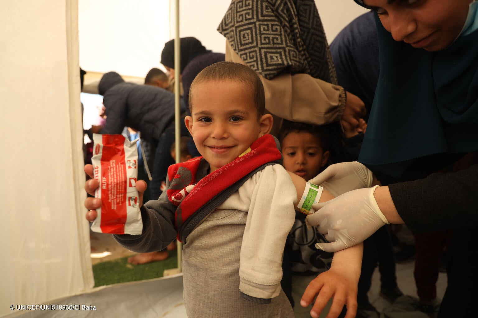上腕計測メジャーで栄養状態を診てもらい、すぐに食べられる栄養治療食(RUTF)を受け取った3歳のアクラムちゃん。(ガザ地区、2024年2月15日撮影) © UNICEF_UNI519936_El Baba