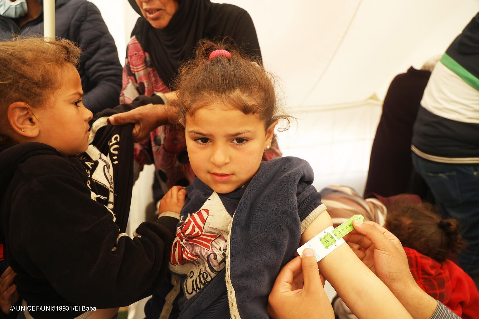 南部ラファにあるユニセフ支援の小児科のテントで、上腕計測メジャーで栄養状態をチェックされている5歳のサマちゃん（ガザ地区、2024年2月15日撮影）&nbsp; © UNICEF_UNI519931_El Baba