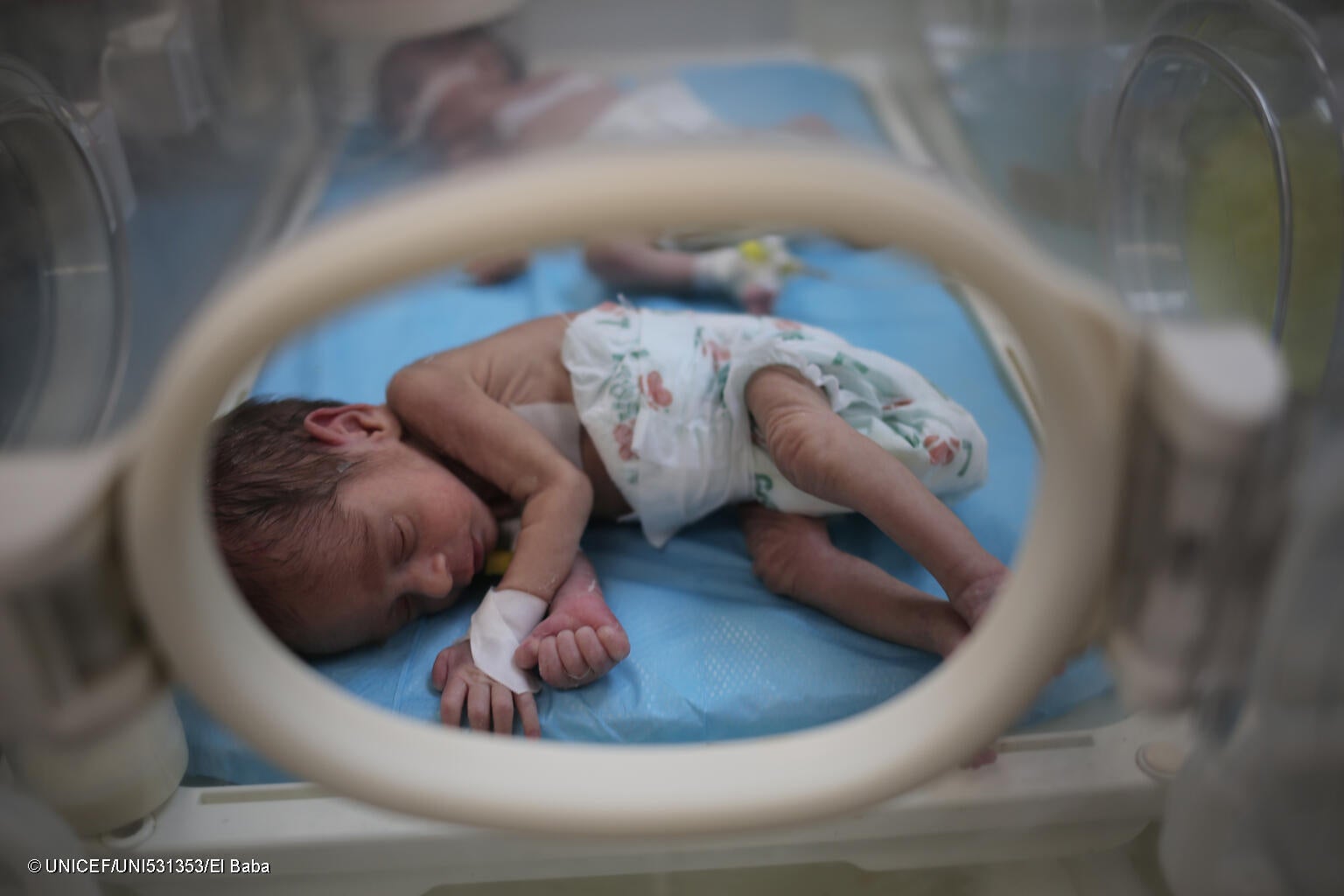 ユニセフの支援でラファの病院に届いた保育器の中で眠る新生児。(ガザ地区、2024年3月5日撮影) © UNICEF_UNI531353_El Baba