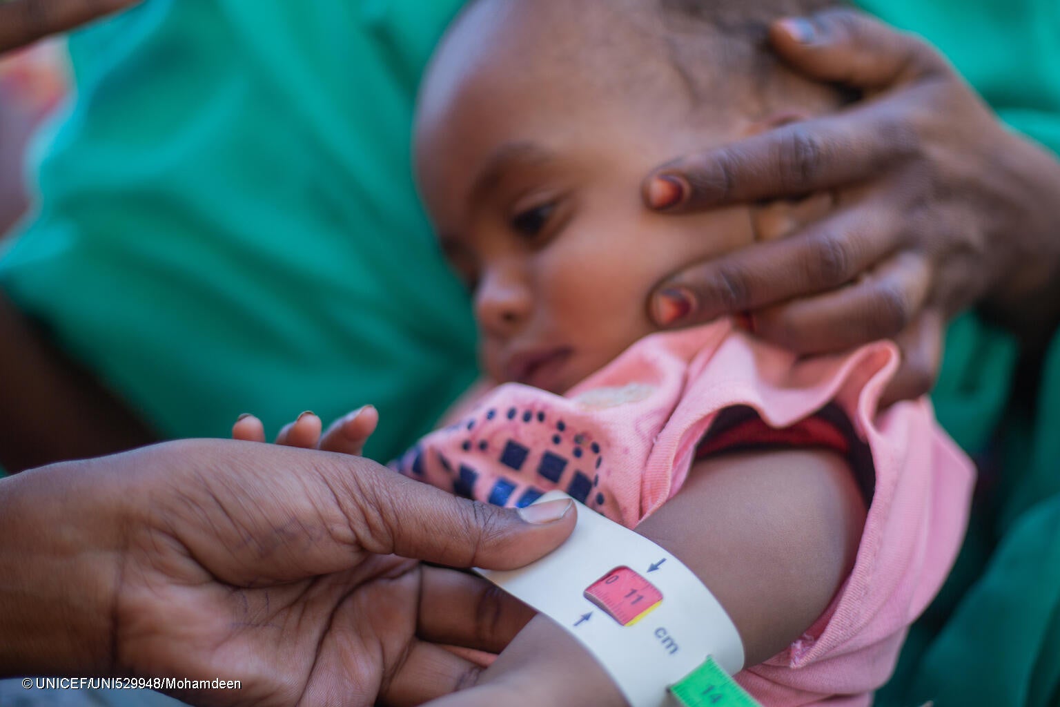 リバーナイル州で5歳未満児を対象とした栄養検査を受ける2歳のアイーダちゃん。上腕計測メジャーを使った検査で重度の栄養不良の「赤」が示され、早急な治療を必要としている。(スーダン、2024年2月29日撮影) © UNICEF_UNI529948_Mohamd