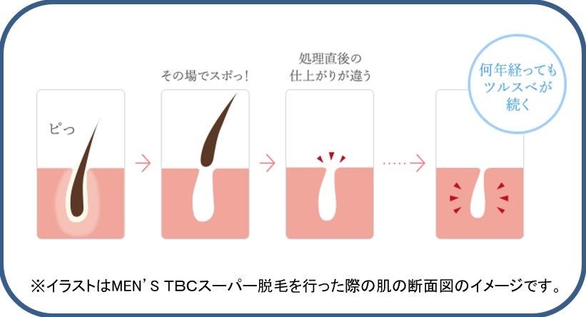 エステティックTBC 公式 TBC 【 2個セット 】 エピワックス