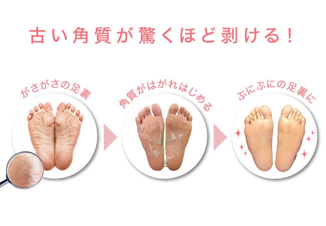 信頼できる角質ケア用品 第1位 を含む3冠獲得 フットピーリングパック ペロリン 素数株式会社のプレスリリース 信頼できる角質ケア用品 第1位 を含む3冠獲得 フットピーリングパック ペロリン 素数株式会社のプレスリリース