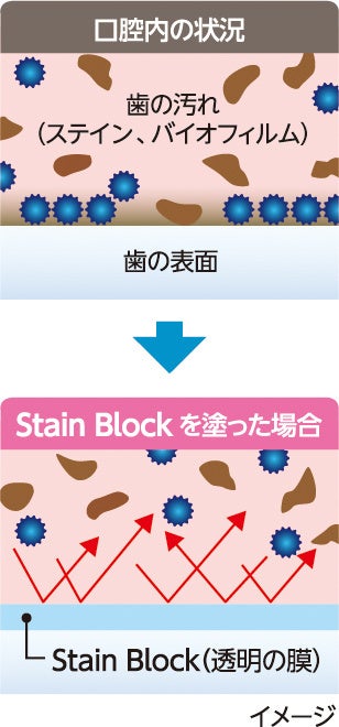 ステインブロックイメージ