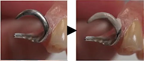 上部塗布例　控えめな白さです。