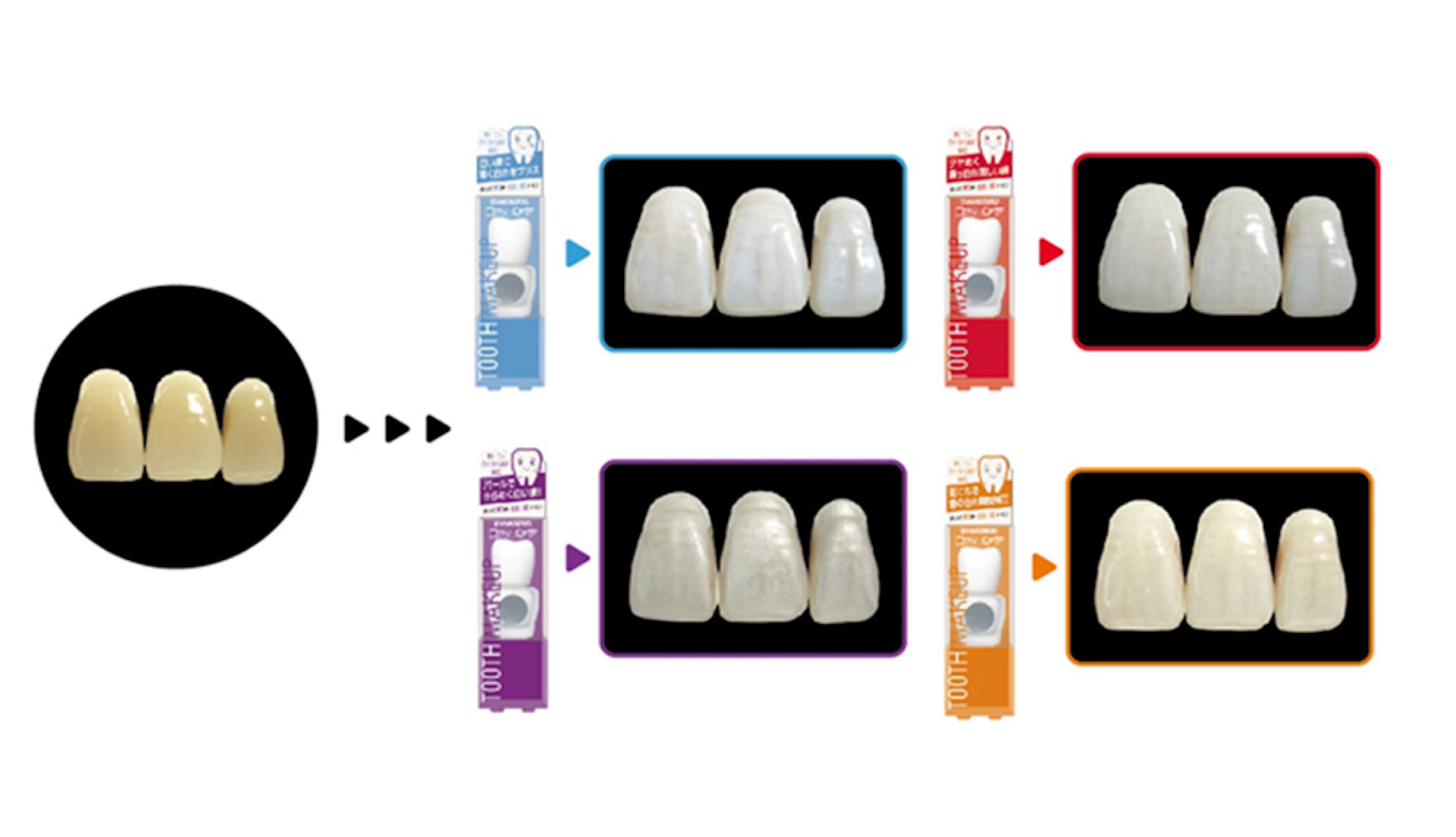 ４色のバリエーション