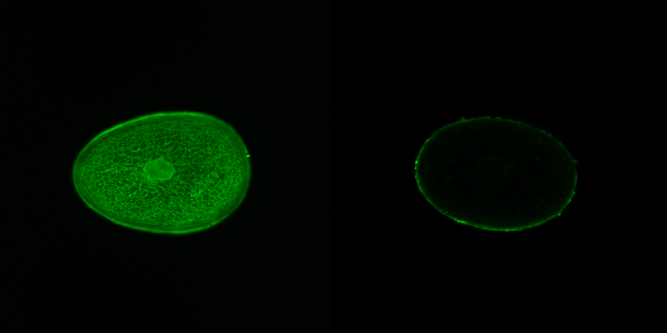 【コレステロールを緑色の蛍光で標識】写真左：HMC + Chol　写真右：untreated