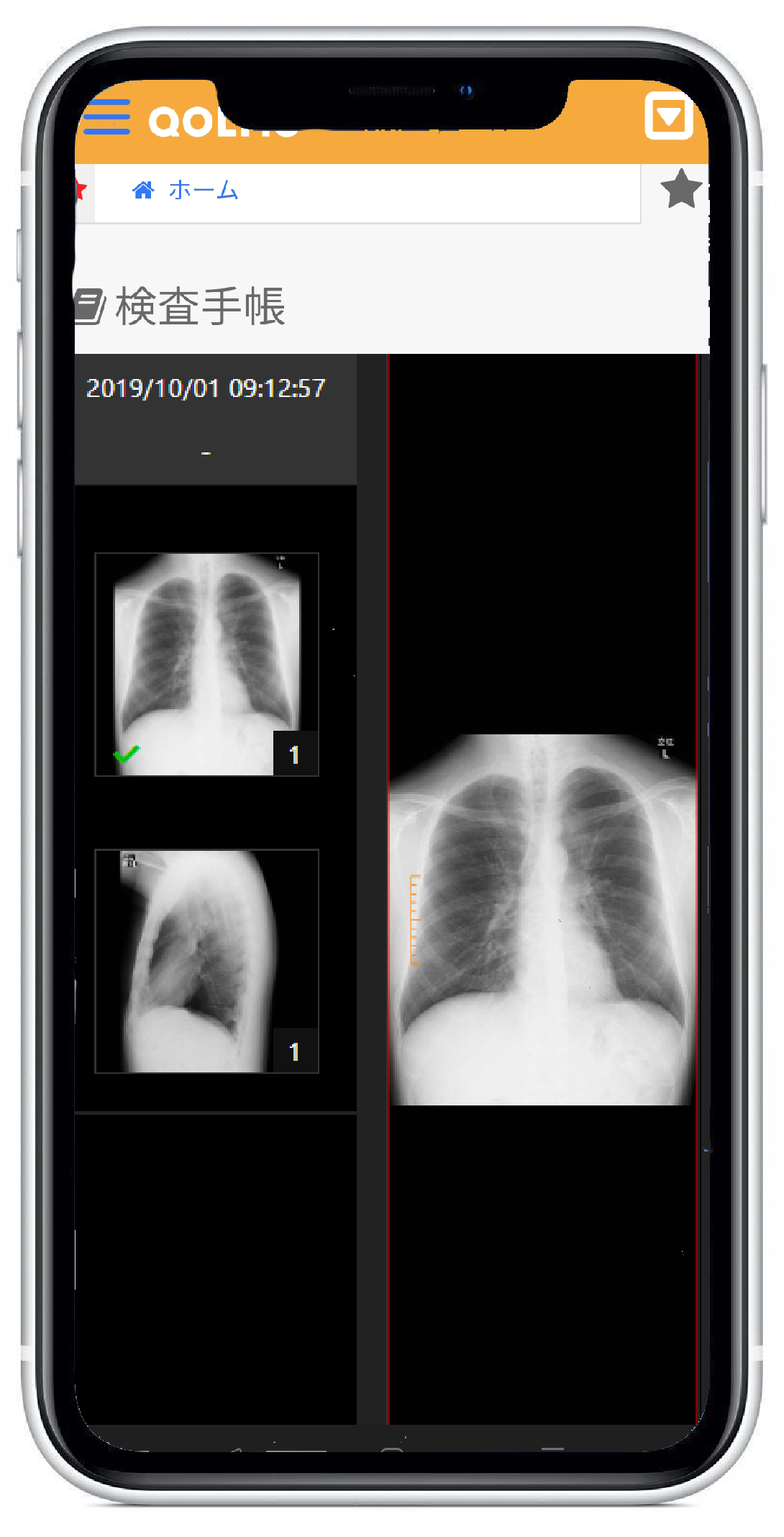 検査手帳にてレントゲン写真の閲覧出来ます。
