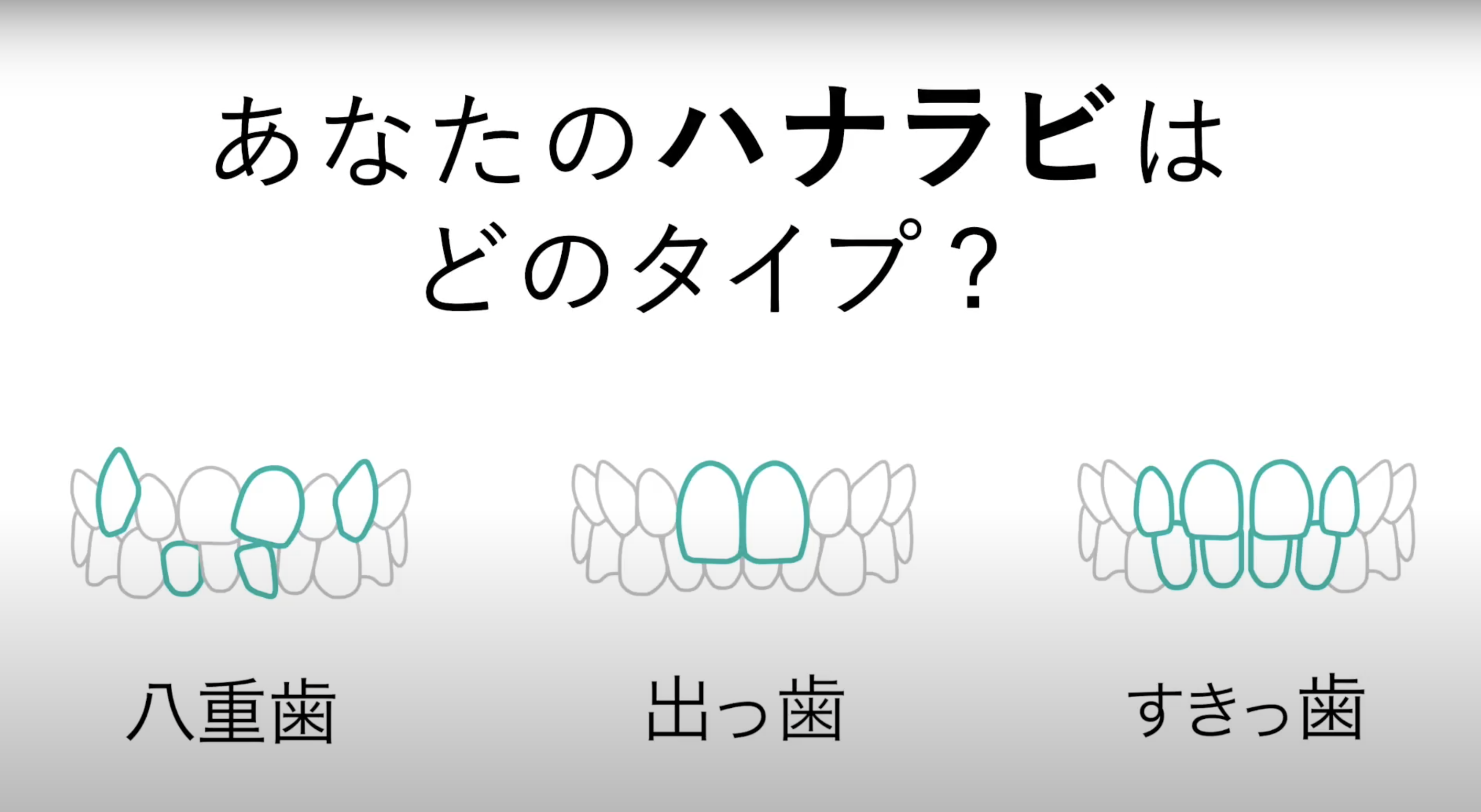 （マウスピース矯正「hanaravi」のウェブCMから）