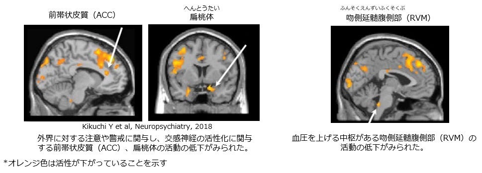 資生堂、東京都立大学との共同研究で「肌へのセルフタッチ」が幸福感に繋がることを解明