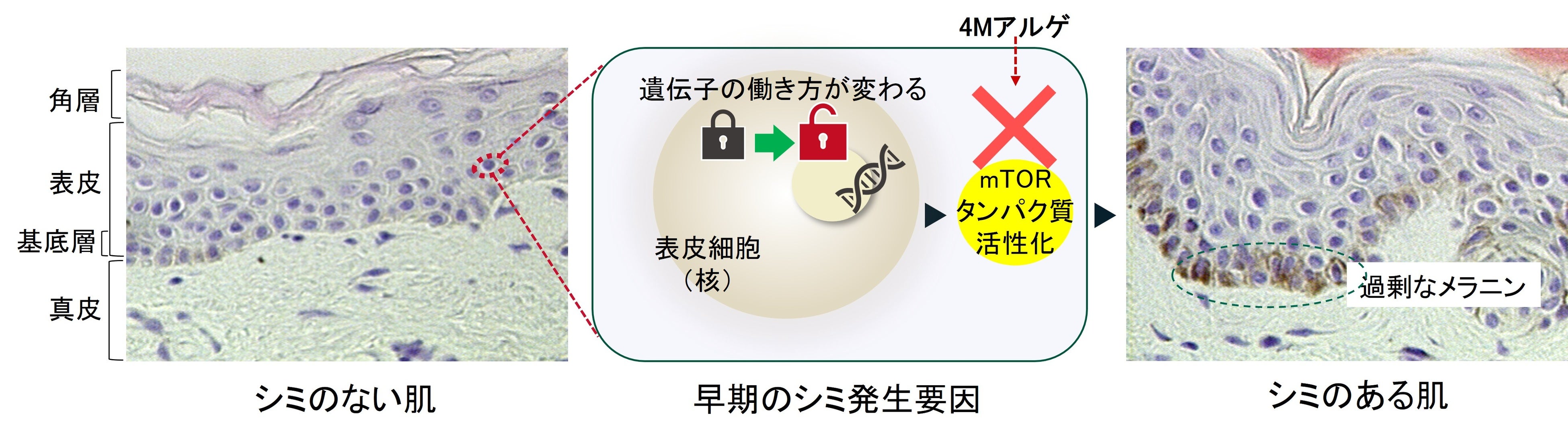 狙いはメラニンの発生源。「SHISEIDO ホワイトルーセント」の新美白