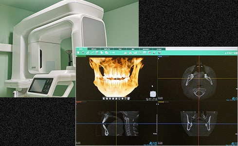 高性能CTスキャン