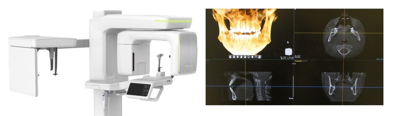 高性能CTスキャン