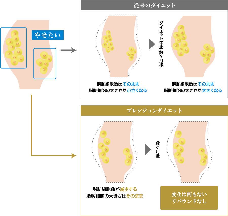 痩せられない原因とは？