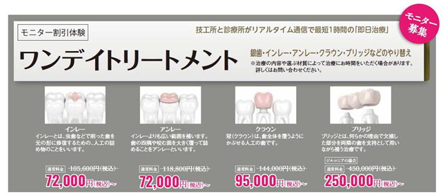 『ワンデイトリートメント』モニター特別価格