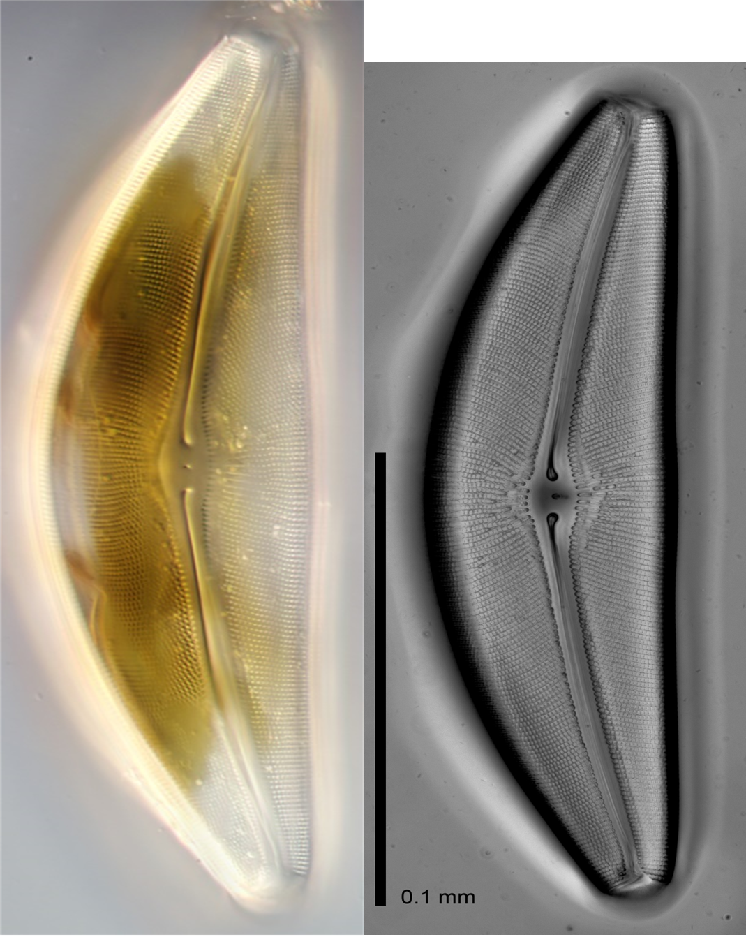 ミズワタクチビルケイソウの生細胞および殻の光学顕微鏡写真