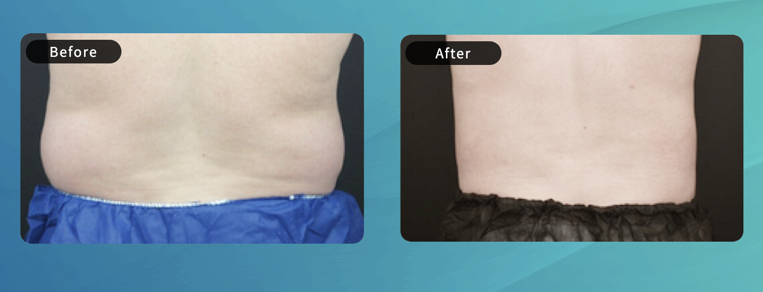 Before After（イメージ画像）