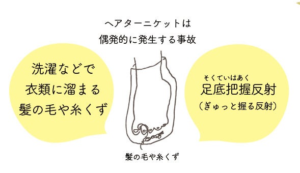 ヘアターニケットとは