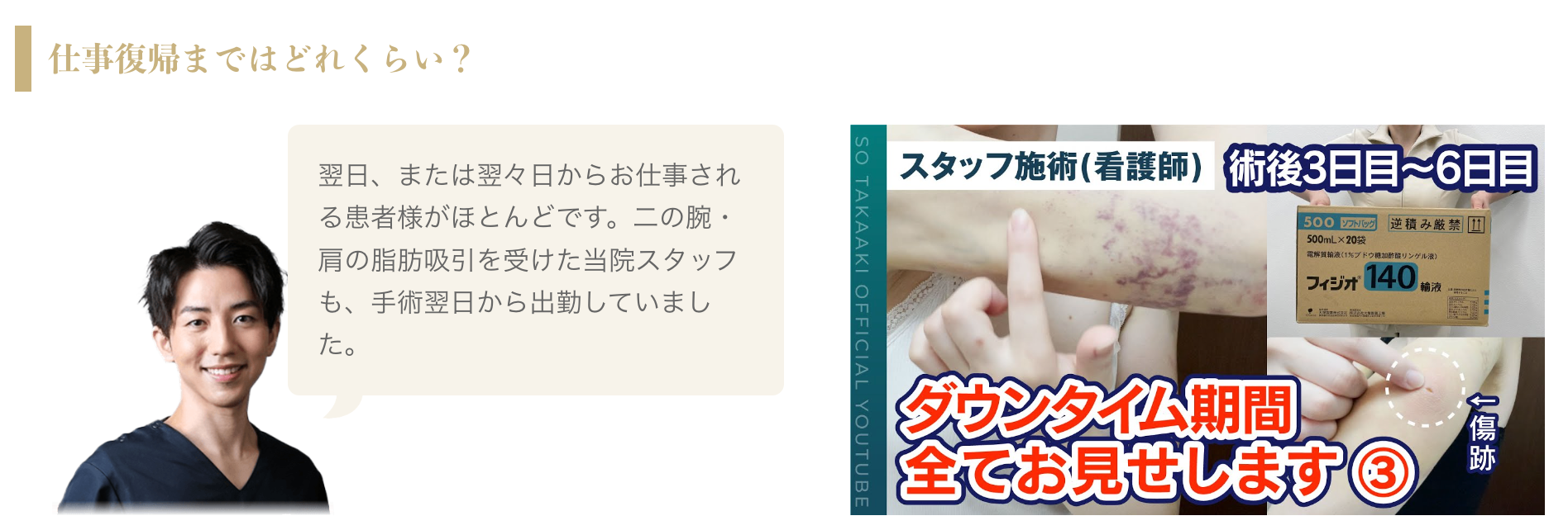 脂肪吸引後のリアルなダウンタイムの様子も見れる
