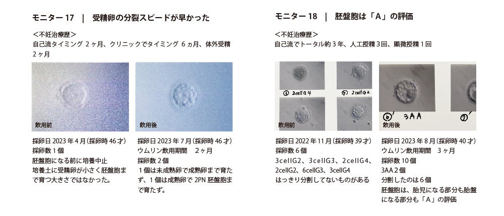 ウムリン＊umulin 60包 愛用サプリ 妊活編①『ウムリン配合umu』 | 45歳不妊歴8年 治療