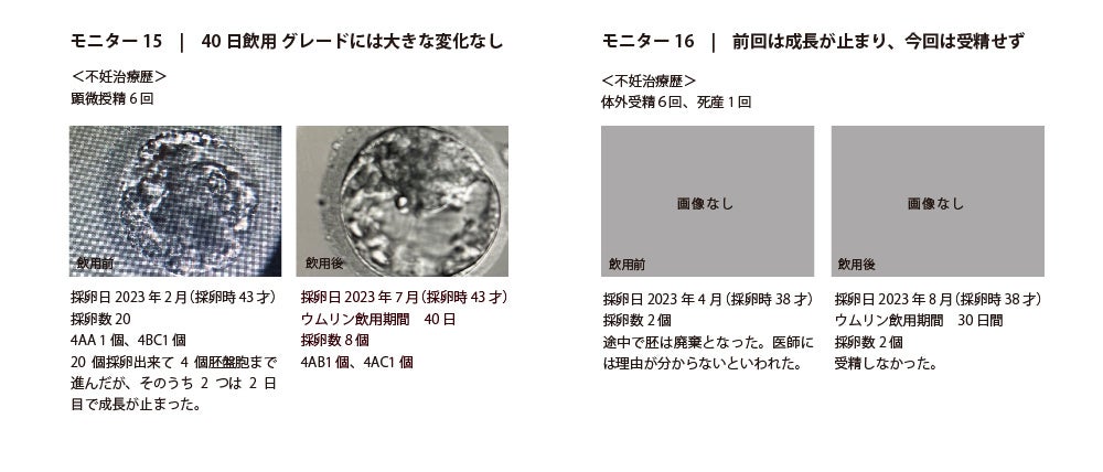 ウムリン＊umulin 60包 Amazon.co.jp: ウムリン 1袋60包入り賞味期限 2026.3 : 食品