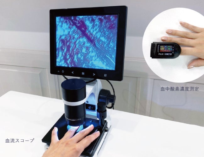 血流スコープで1回で血流がみえる。