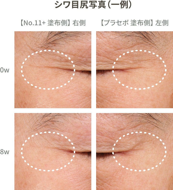 エイジング悩みまでも救う史上初のダブル改善有効成分が誕生