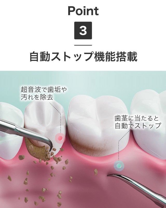 口腔洗浄器 999以上歯垢除去力 クリーニング （クリーニング 999
