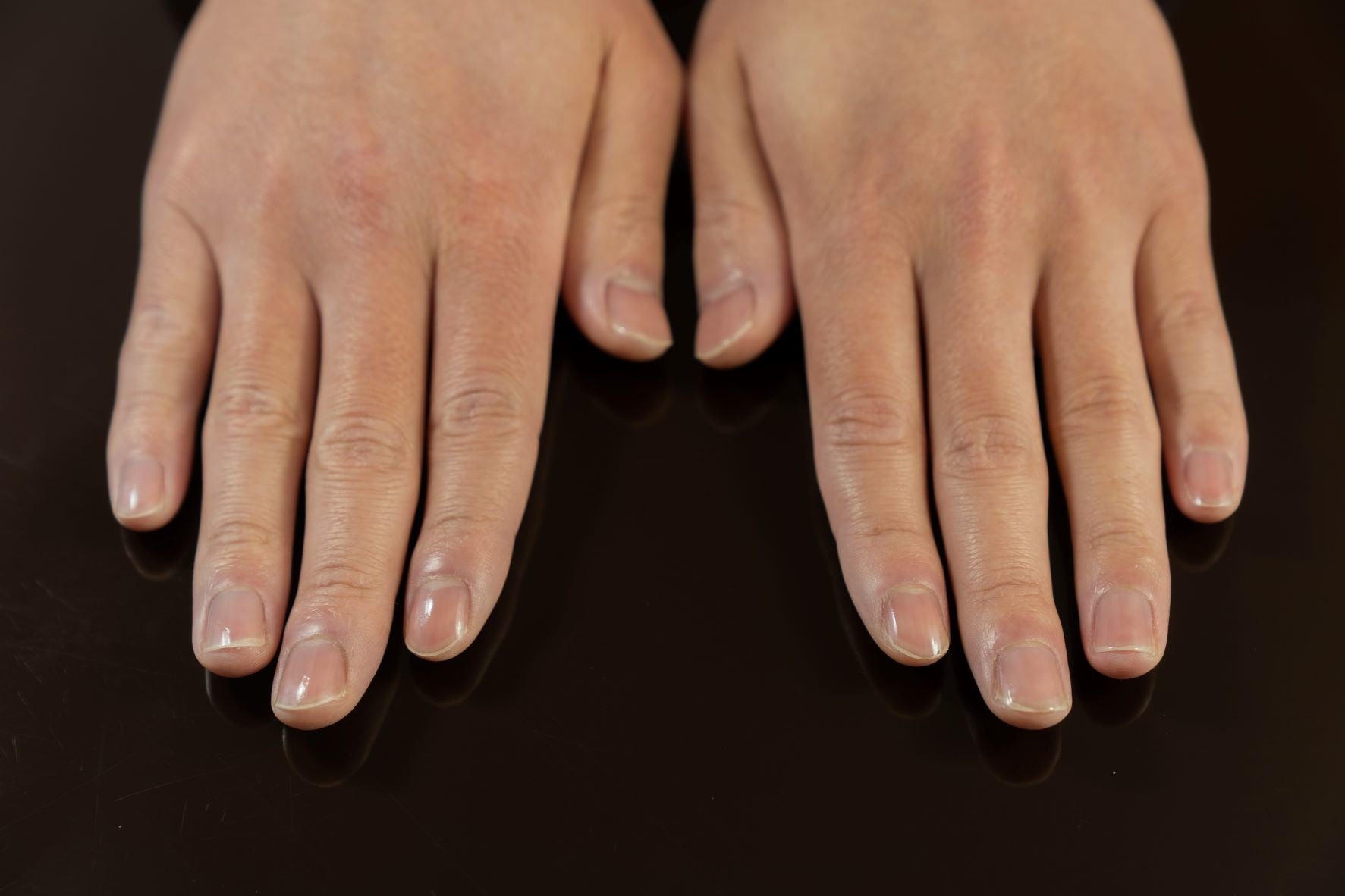 健康的な爪先をつくります