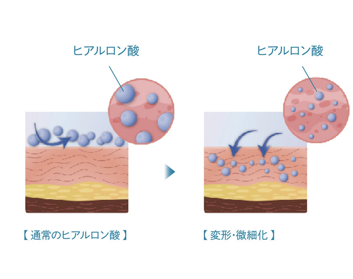 マイクロ循環浸透技術