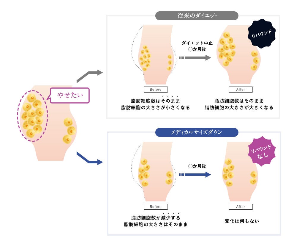 “メディカルサイズダウン”シリーズのリバウンドしづらい仕組み
