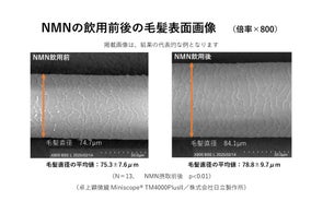 NMNの経口摂取が毛髪に及ぼす影響に関する臨床試験を実施
