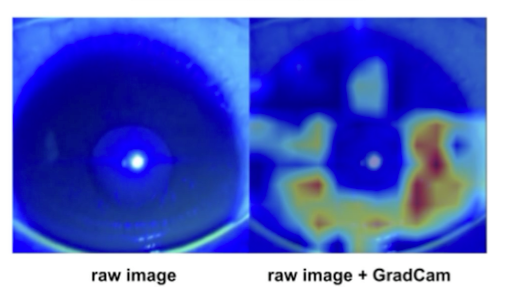 図2. GradCAMによる可視化