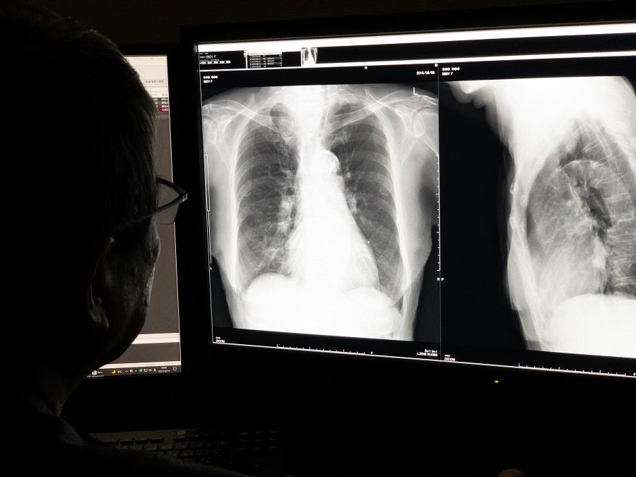 遠隔読影のイメージ