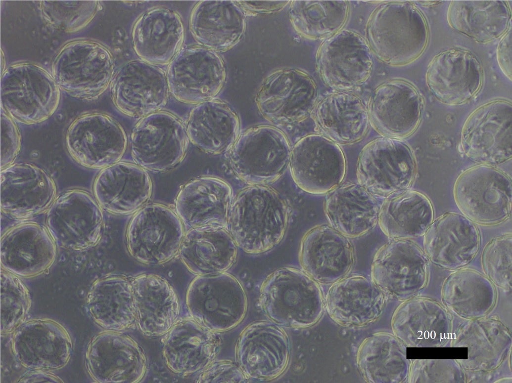 マイクロキャリア上のヒト間葉系幹細胞の顕微鏡像（提供：大阪大学工学研究科 紀ノ岡研究室）