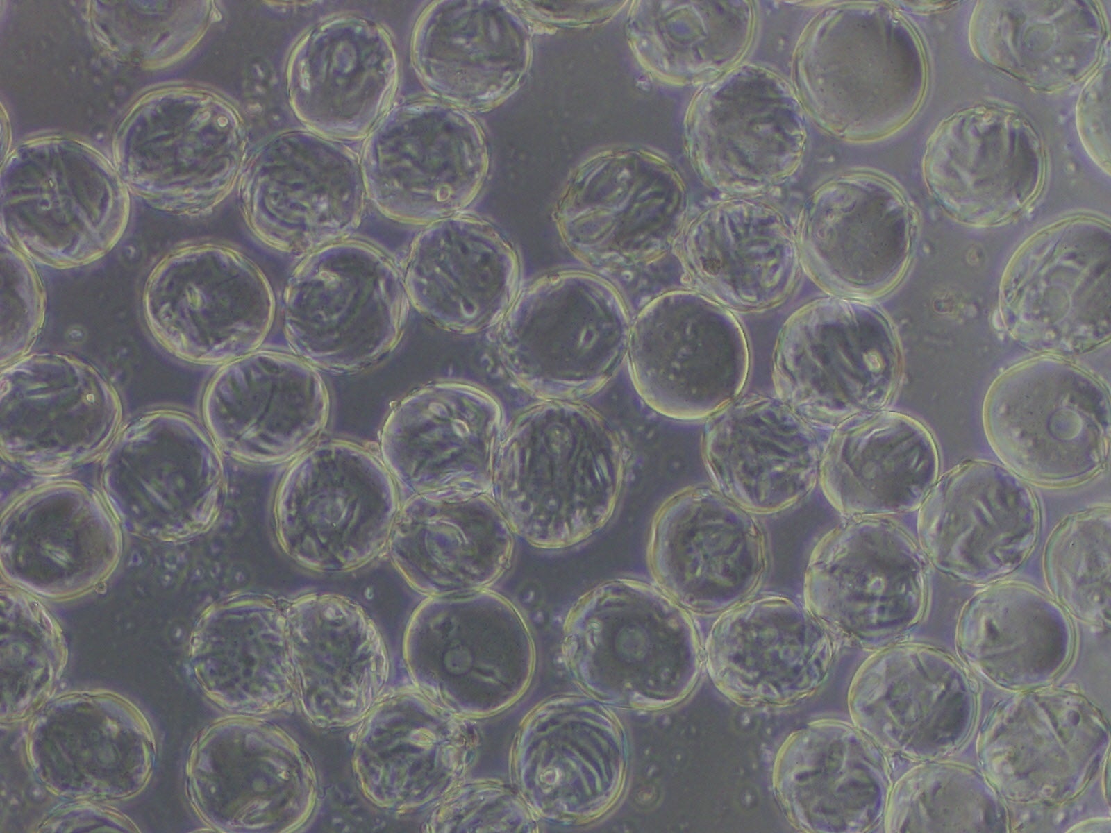 マイクロキャリア上のヒト間葉系幹細胞の顕微鏡像（提供：大阪大学工学研究科 紀ノ岡研究室）