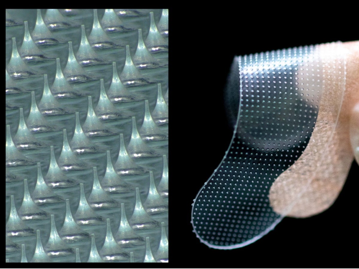 発明功労賞を受賞した「溶解型マイクロニードル」