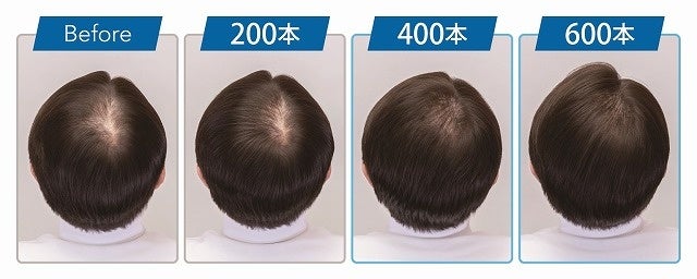 ※増毛イメージ例