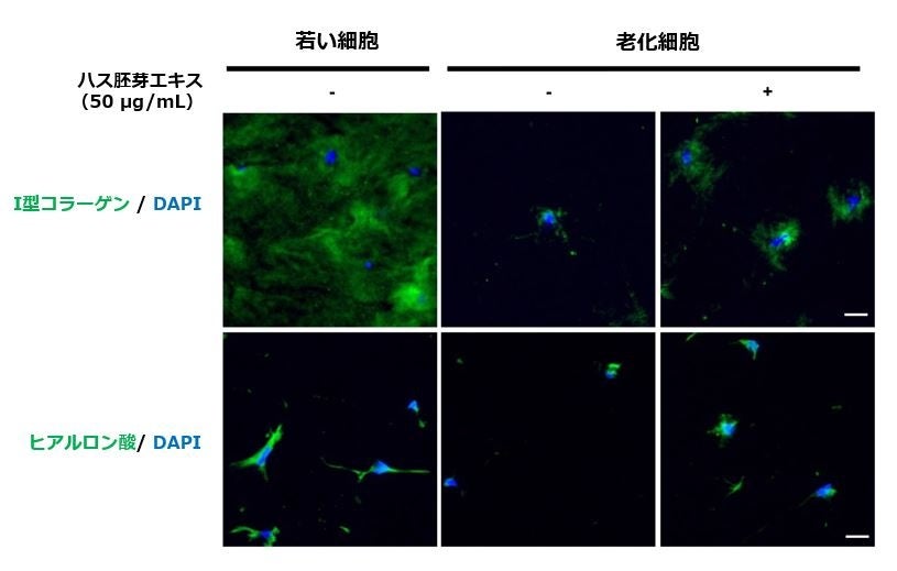 老化研究の最前線 細胞の「若返り」に着目した先端研究とハス